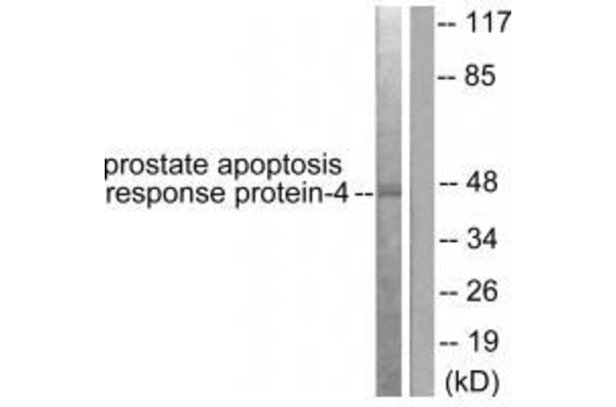 Western blot - Prostate Apoptosis Response Protein-4 Antibody from Signalway Antibody (33475) - Antibodies.com