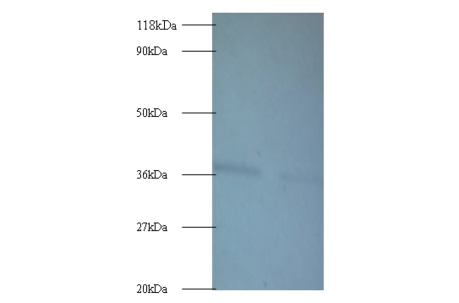 ATP synthase subunit delta Polyclonal Antibody from Signalway Antibody (42141) - Antibodies.com