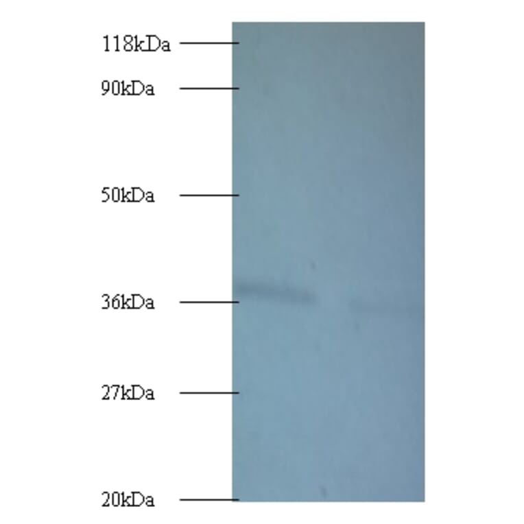 ATP synthase subunit delta Polyclonal Antibody from Signalway Antibody (42141) - Antibodies.com
