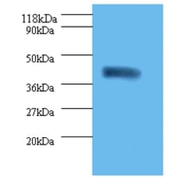 Acid-sensing ion channel 3 Polyclonal Antibody from Signalway Antibody (42434) - Antibodies.com