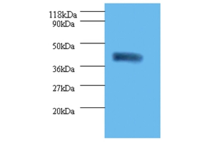 Acid-sensing ion channel 3 Polyclonal Antibody from Signalway Antibody (42434) - Antibodies.com
