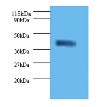 Acid-sensing ion channel 3 Polyclonal Antibody from Signalway Antibody (42434) - Antibodies.com