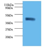 Acid-sensing ion channel 3 Polyclonal Antibody from Signalway Antibody (42434) - Antibodies.com