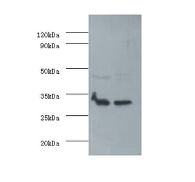 Fibroblast growth factor 2 Polyclonal Antibody from Signalway Antibody (42563) - Antibodies.com