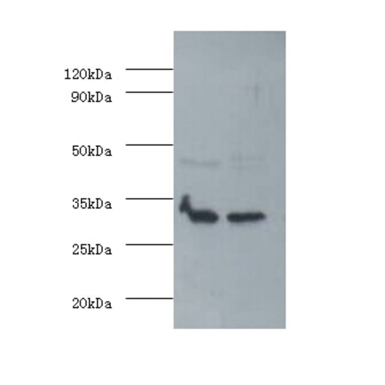 Fibroblast growth factor 2 Polyclonal Antibody from Signalway Antibody (42563) - Antibodies.com