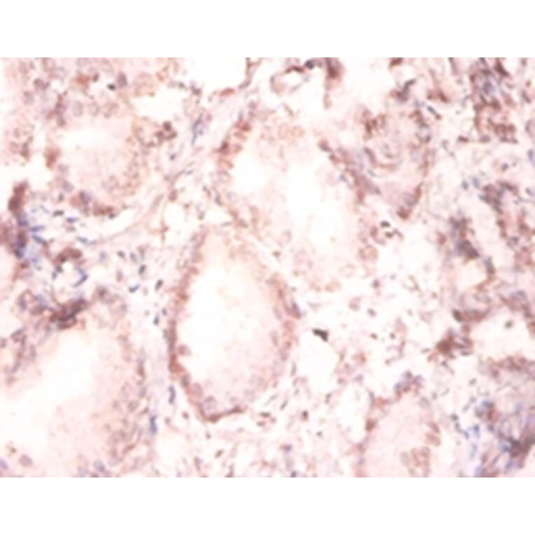 Immunohistochemistry - Fibroblast growth factor 2 Polyclonal Antibody from Signalway Antibody - Antibodies.com