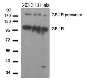 Western blot - IGF-1R (Ab-1280) Antibody from Signalway Antibody (21302) - Antibodies.com