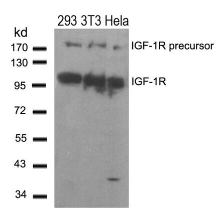 Western blot - IGF-1R (Ab-1280) Antibody from Signalway Antibody (21302) - Antibodies.com