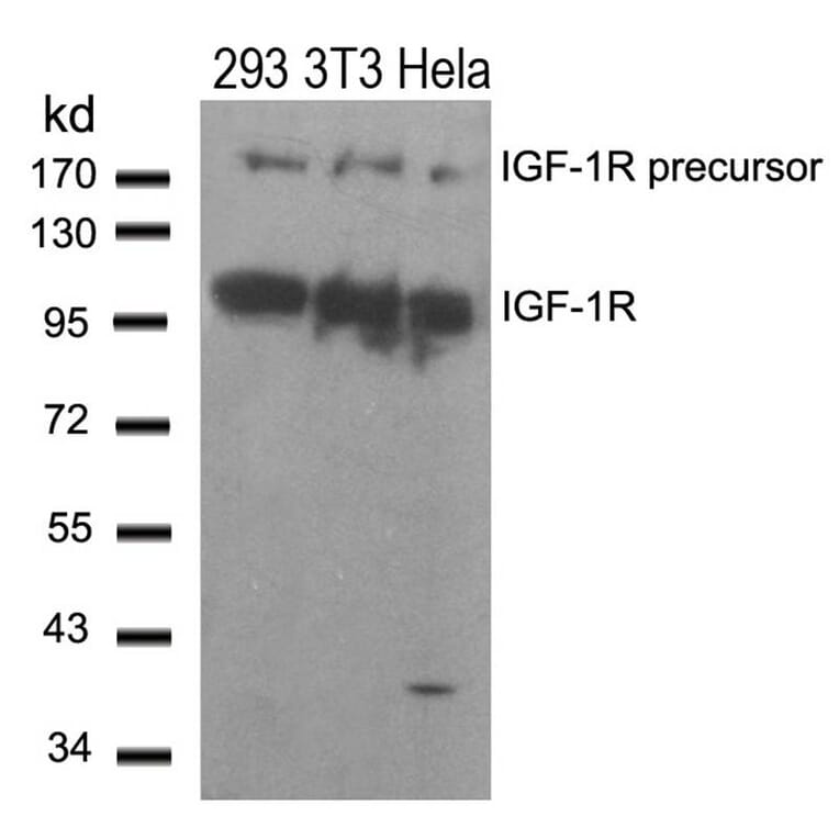 Western blot - IGF-1R (Ab-1280) Antibody from Signalway Antibody (21302) - Antibodies.com