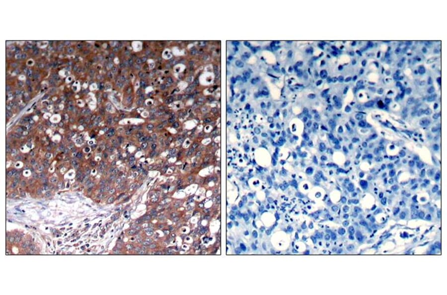 Immunohistochemistry - IGF-1R (Ab-1280) Antibody from Signalway Antibody (21302) - Antibodies.com