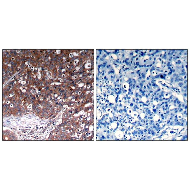 Immunohistochemistry - IGF-1R (Ab-1280) Antibody from Signalway Antibody (21302) - Antibodies.com