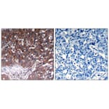 Immunohistochemistry - IGF-1R (Ab-1280) Antibody from Signalway Antibody (21302) - Antibodies.com
