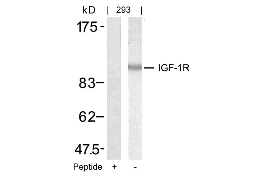 Western blot - IGF-1R (Ab-1346) Antibody from Signalway Antibody (21303) - Antibodies.com