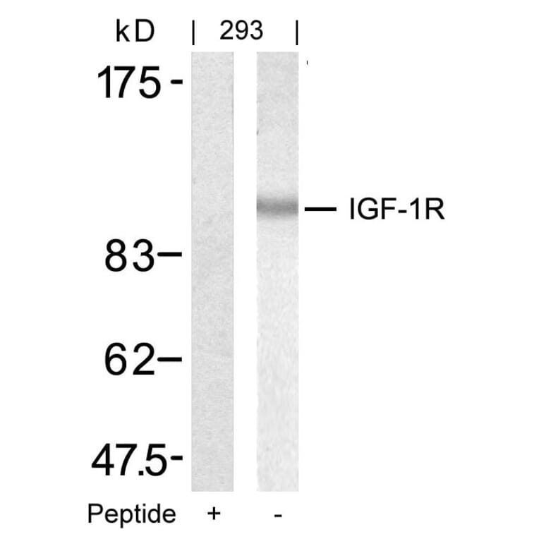 Western blot - IGF-1R (Ab-1346) Antibody from Signalway Antibody (21303) - Antibodies.com