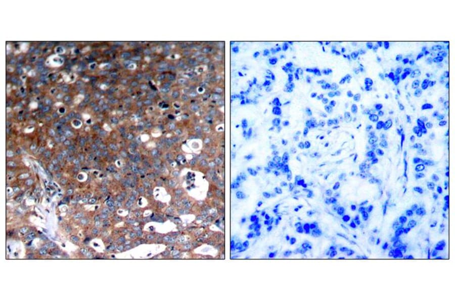 Immunohistochemistry - IGF-1R (Ab-1346) Antibody from Signalway Antibody (21303) - Antibodies.com