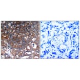 Immunohistochemistry - IGF-1R (Ab-1346) Antibody from Signalway Antibody (21303) - Antibodies.com