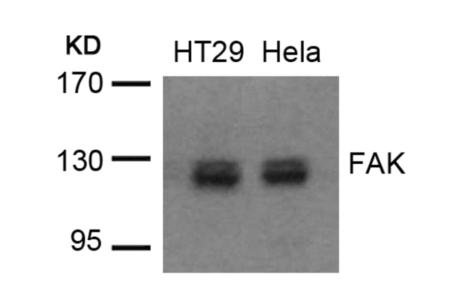 Western blot - FAK (Ab-576/577) Antibody from Signalway Antibody (21545) - Antibodies.com