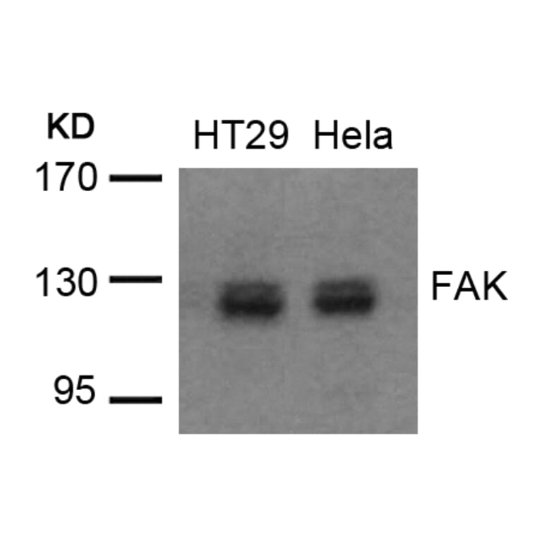 Western blot - FAK (Ab-576/577) Antibody from Signalway Antibody (21545) - Antibodies.com