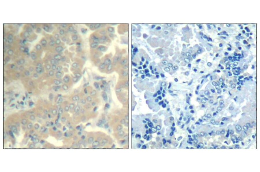 Immunohistochemistry - FAK (Ab-576/577) Antibody from Signalway Antibody (21545) - Antibodies.com