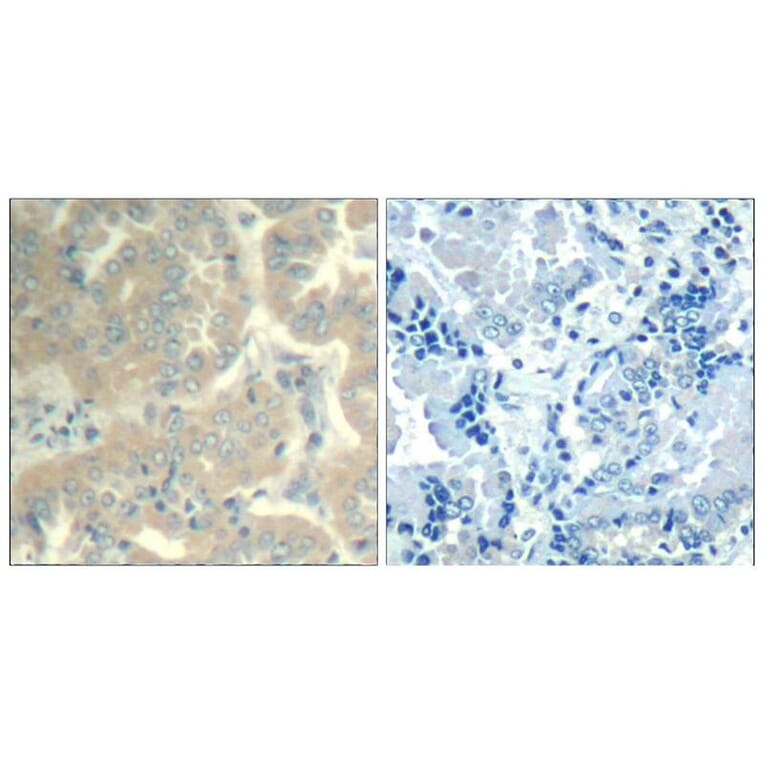 Immunohistochemistry - FAK (Ab-576/577) Antibody from Signalway Antibody (21545) - Antibodies.com