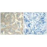 Immunohistochemistry - FAK (Ab-576/577) Antibody from Signalway Antibody (21545) - Antibodies.com