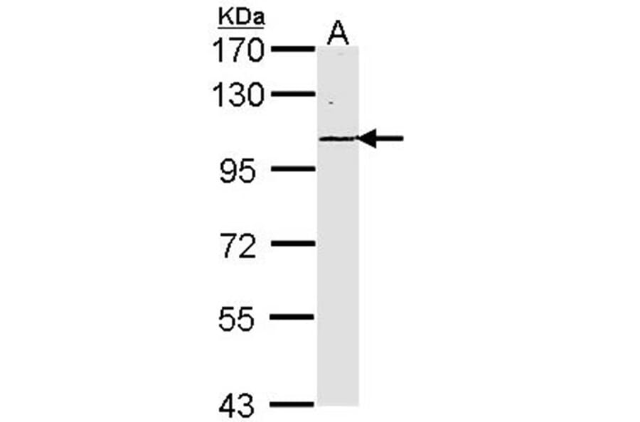 Laminin gamma-2 antibody from Signalway Antibody (22201) - Antibodies.com