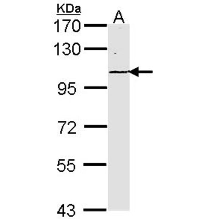 Laminin gamma-2 antibody from Signalway Antibody (22201) - Antibodies.com
