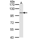 Laminin gamma-2 antibody from Signalway Antibody (22201) - Antibodies.com