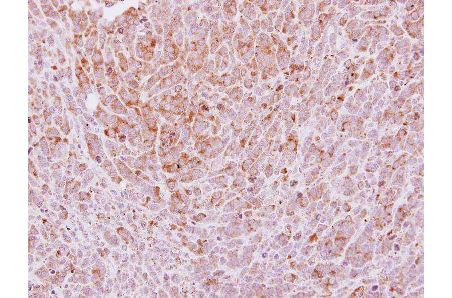 Immunohistochemistry - Laminin gamma-2 antibody from Signalway Antibody (22201) - Antibodies.com
