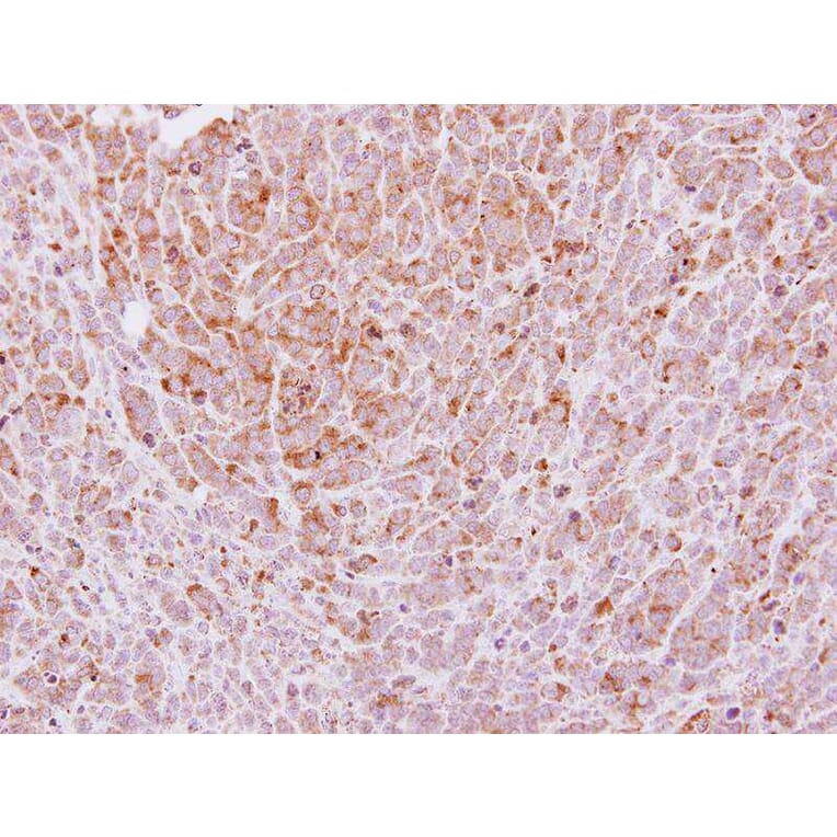 Immunohistochemistry - Laminin gamma-2 antibody from Signalway Antibody (22201) - Antibodies.com