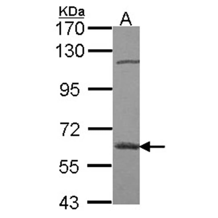 beta-glucosidase antibody from Signalway Antibody (22358) - Antibodies.com