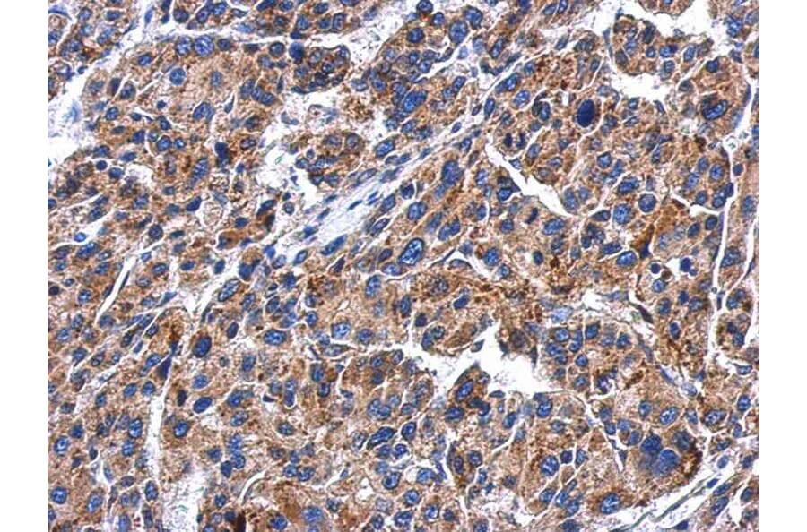 Immunohistochemistry - beta-glucosidase antibody from Signalway Antibody (22358) - Antibodies.com