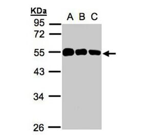 calsequestrin 1 antibody from Signalway Antibody (22979) - Antibodies.com