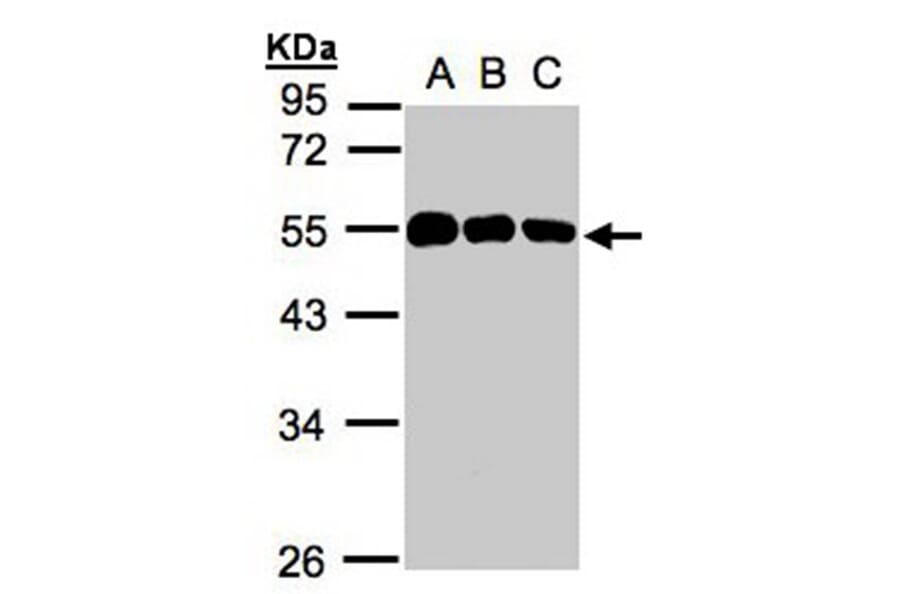 calsequestrin 1 antibody from Signalway Antibody (22979) - Antibodies.com