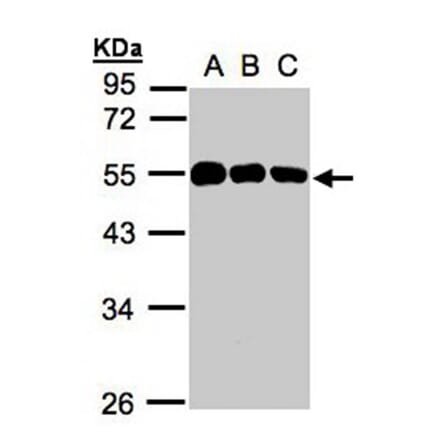 calsequestrin 1 antibody from Signalway Antibody (22979) - Antibodies.com