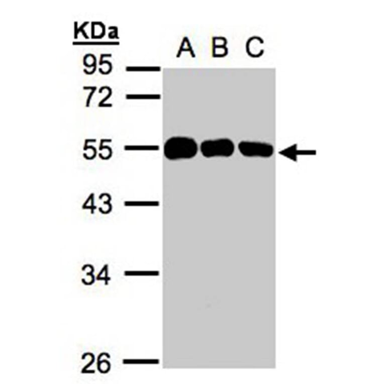 calsequestrin 1 antibody from Signalway Antibody (22979) - Antibodies.com