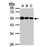 calsequestrin 1 antibody from Signalway Antibody (22979) - Antibodies.com