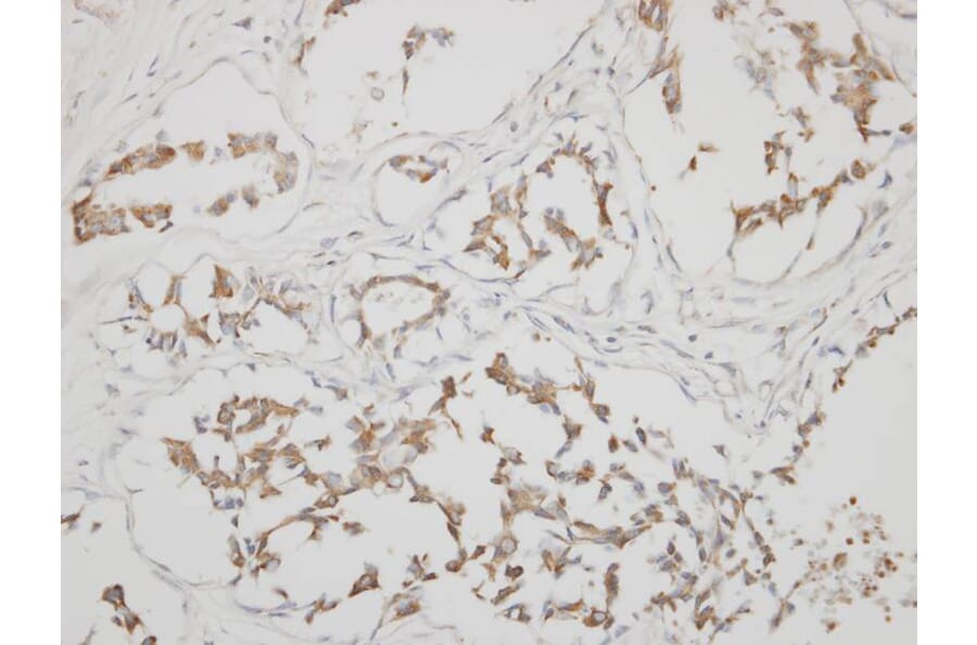 Immunohistochemistry - calsequestrin 1 antibody from Signalway Antibody (22979) - Antibodies.com