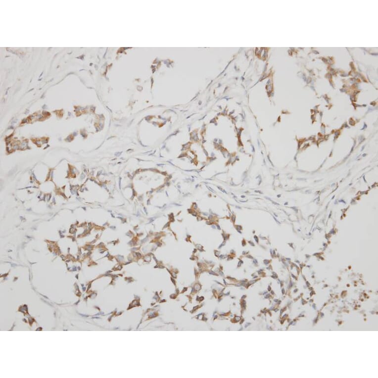 Immunohistochemistry - calsequestrin 1 antibody from Signalway Antibody (22979) - Antibodies.com