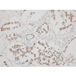 Immunohistochemistry - calsequestrin 1 antibody from Signalway Antibody (22979) - Antibodies.com