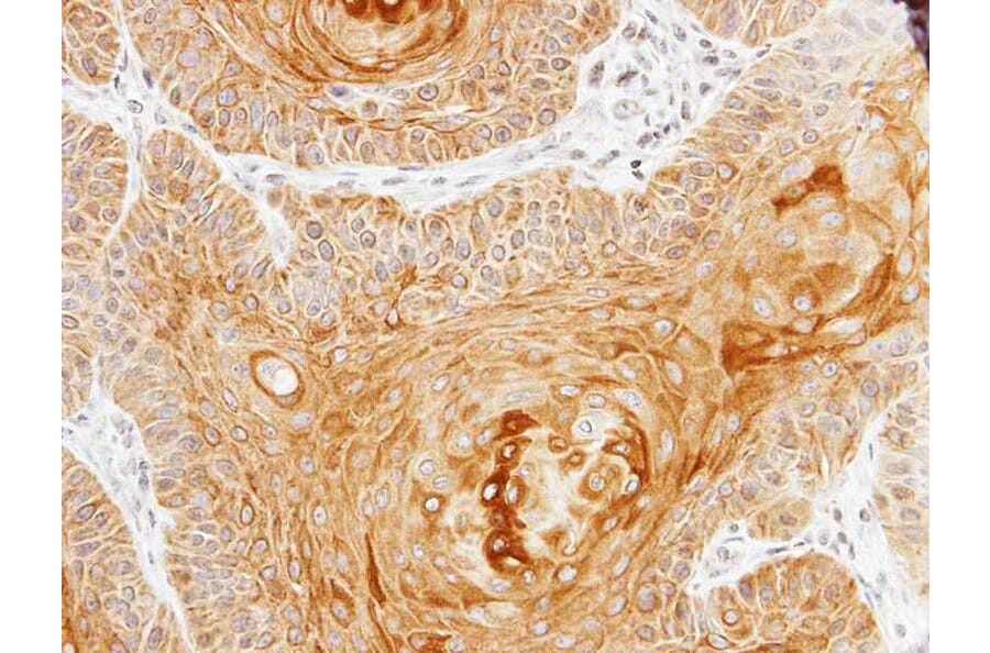 Immunohistochemistry - pan-Cytokeratin antibody from Signalway Antibody (23032) - Antibodies.com