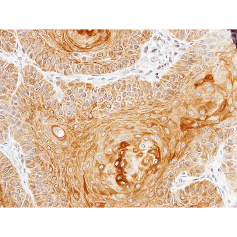 Immunohistochemistry - pan-Cytokeratin antibody from Signalway Antibody (23032) - Antibodies.com