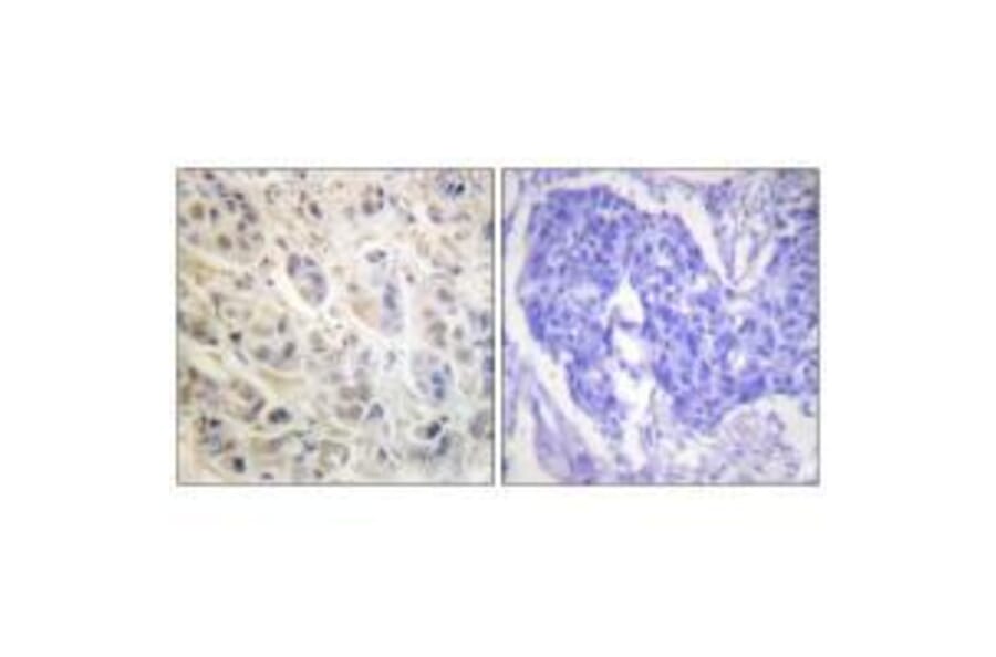 Immunohistochemistry - p90 RSK (Ab-573) Antibody from Signalway Antibody (33139) - Antibodies.com