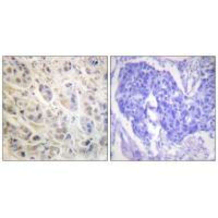 Immunohistochemistry - p90 RSK (Ab-573) Antibody from Signalway Antibody (33139) - Antibodies.com