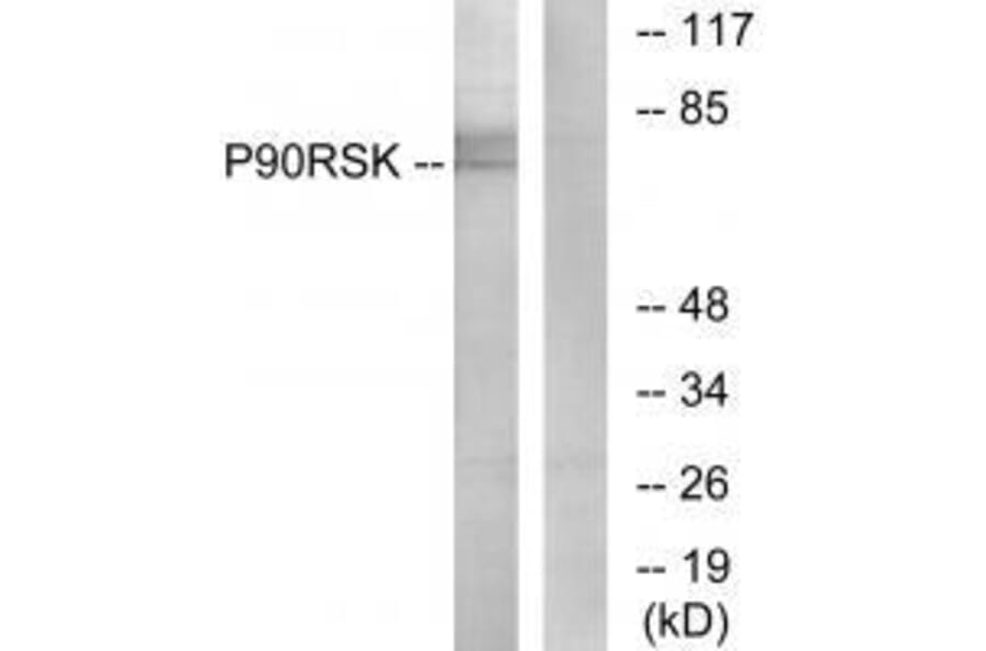 Western blot - p90 RSK (Ab-573) Antibody from Signalway Antibody (33139) - Antibodies.com