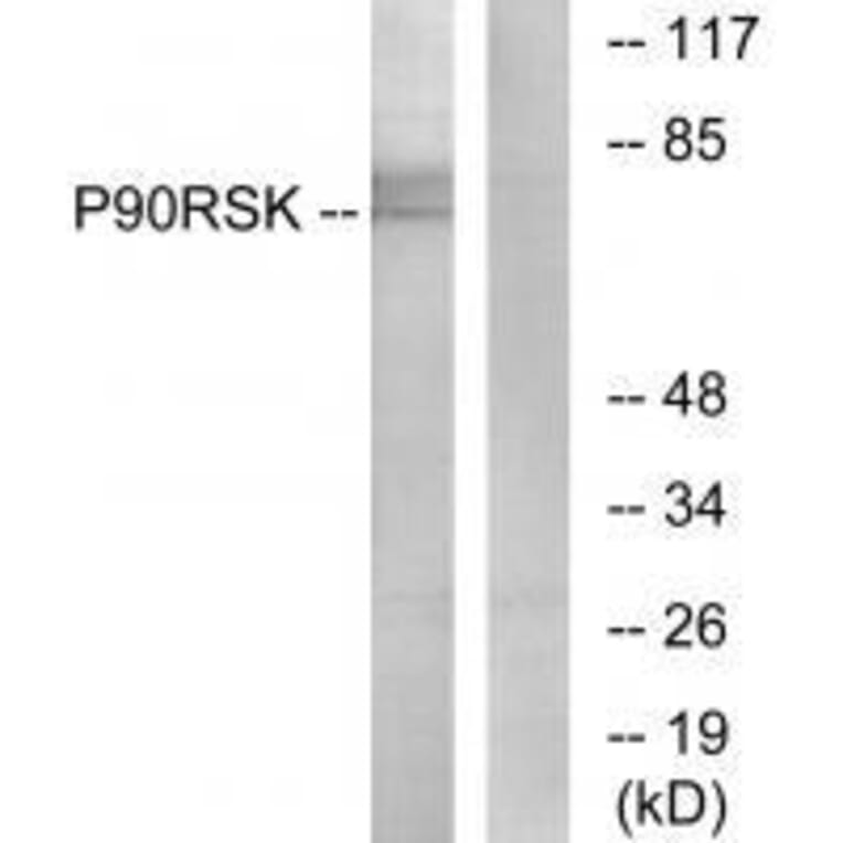 Western blot - p90 RSK (Ab-573) Antibody from Signalway Antibody (33139) - Antibodies.com
