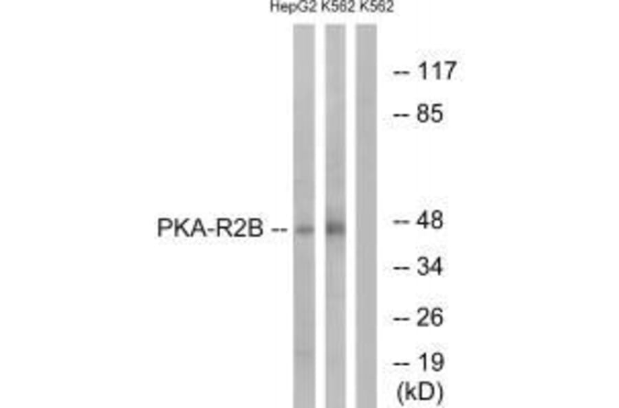 Western blot - PKA-R2β (Ab-113) Antibody from Signalway Antibody (33161) - Antibodies.com