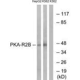 Western blot - PKA-R2β (Ab-113) Antibody from Signalway Antibody (33161) - Antibodies.com