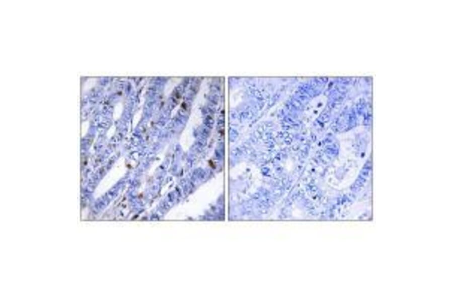 Immunohistochemistry - PKA-R2β (Ab-113) Antibody from Signalway Antibody (33161) - Antibodies.com
