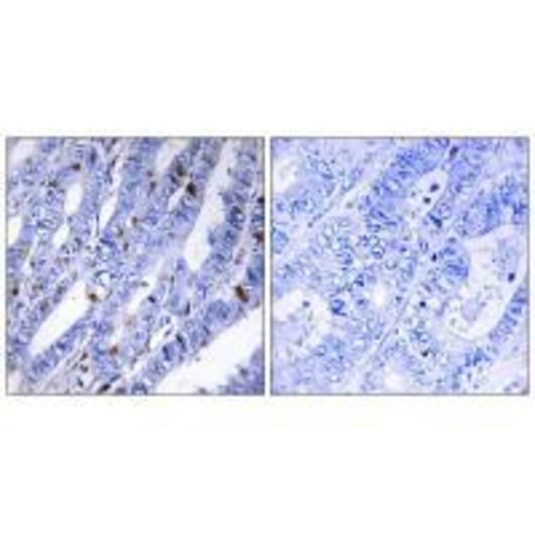 Immunohistochemistry - PKA-R2β (Ab-113) Antibody from Signalway Antibody (33161) - Antibodies.com